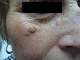 mole-removal-windsor